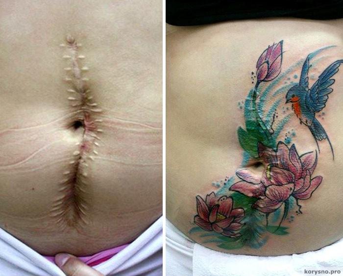 Этот мастер делает бесплатные тату пострадавшим женщинам