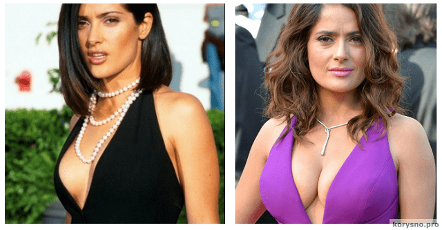 10 голливудских знаменитостей с самой дорогой искусственной грудью