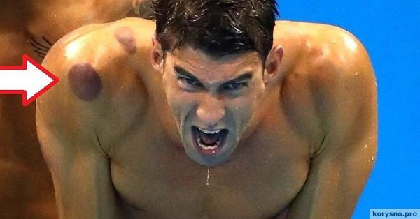 Сюрпризы Олимпийских игр в Рио: уже несколько атлетов были замечены с синяками