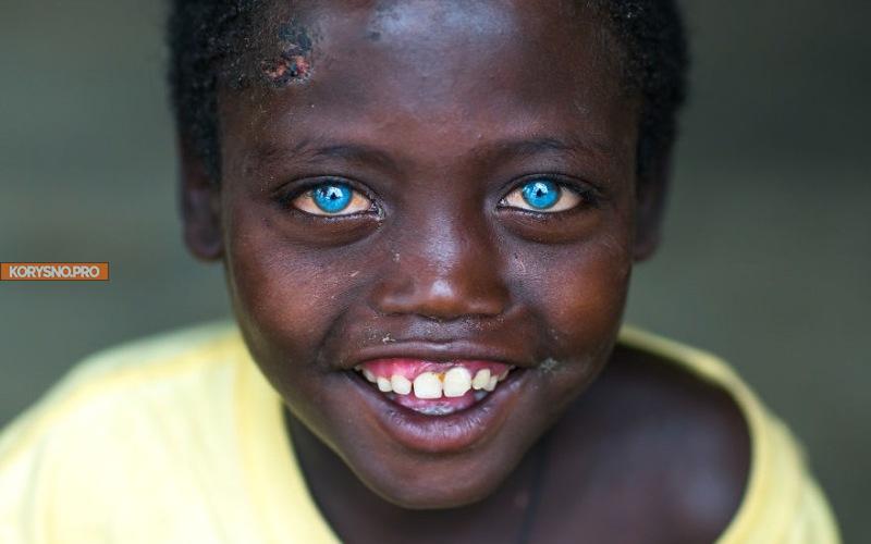Этот мальчуган нищенствовал в трущобах Эфиопии, но теперь стал всемирной знаменитостью!